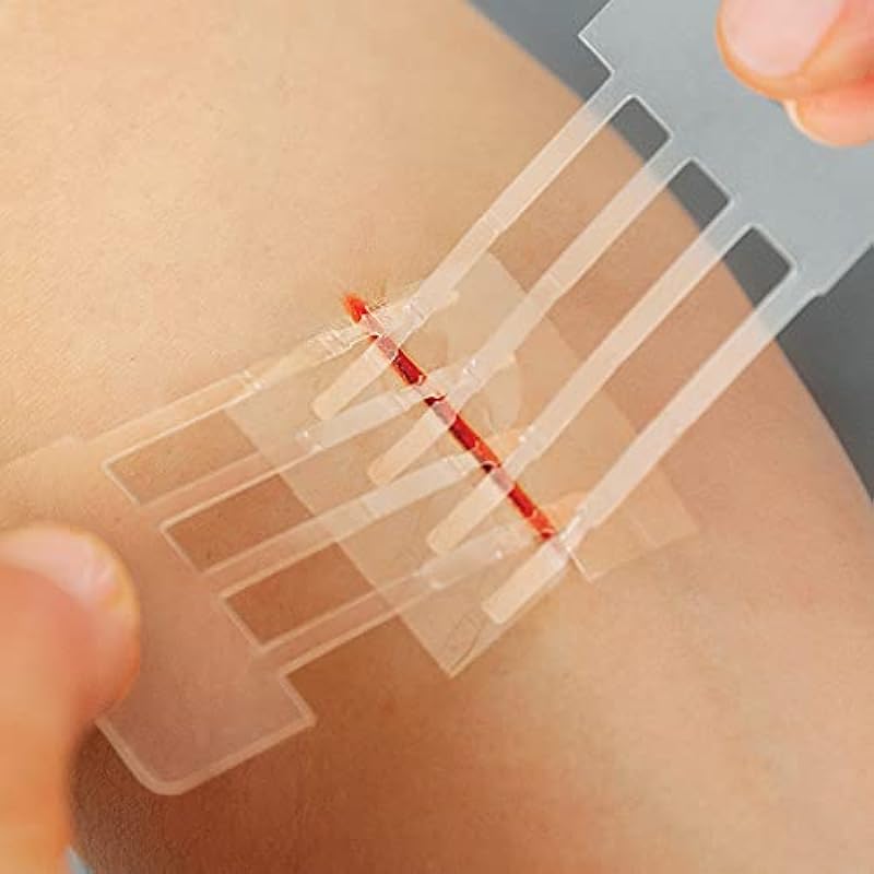 Clozex Emergency Laceration Closures – Repair Wounds Without Stitches. FDA Cleared Skin Closure Device for 3 Individual Wounds Or Combine for Total Length of 4 1/4 Inches.